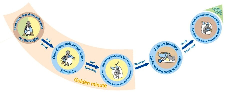 Golden minute Golden Minute Instructions on the BabySaver resuscitation kit